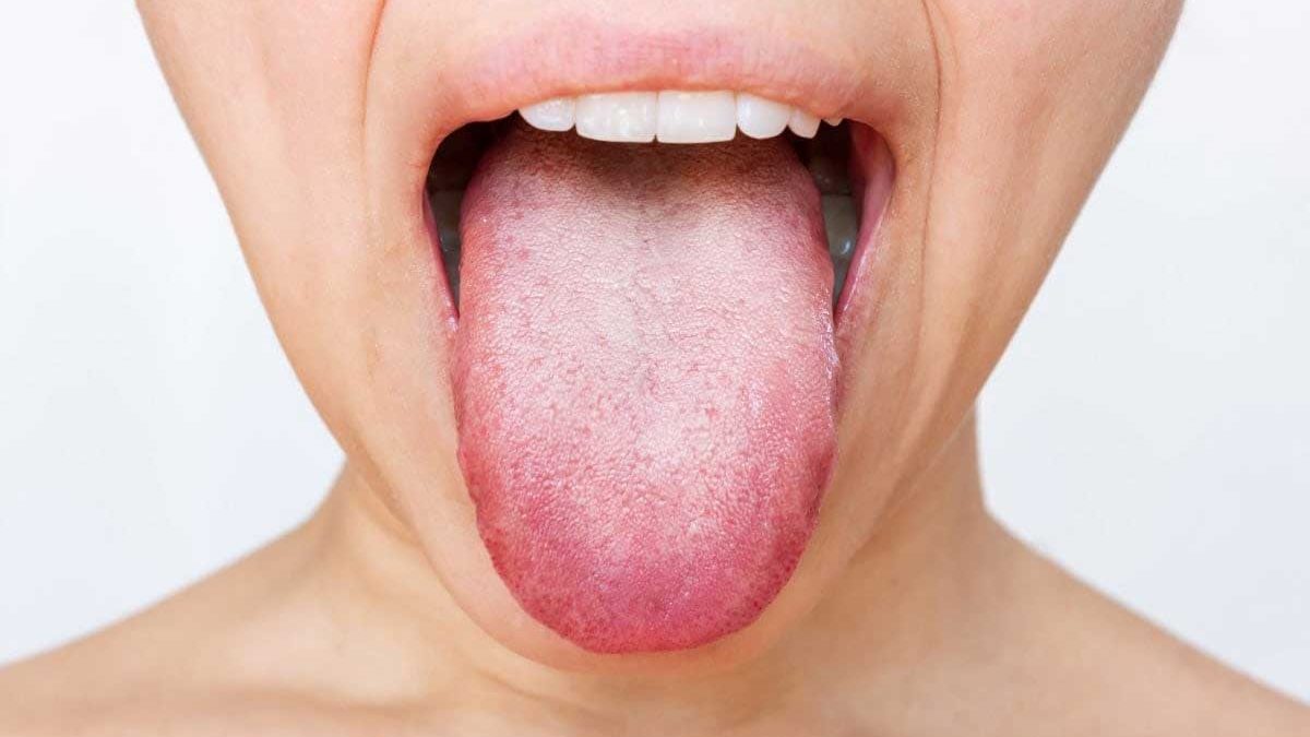¿Qué es la microbiota oral?