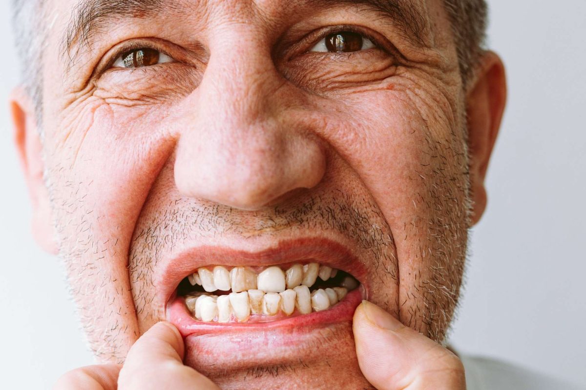 Cuidado dental en la tercera edad. Guía práctica.
