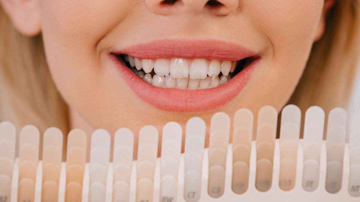 Curiosidades y consejos sobre el color de los dientes