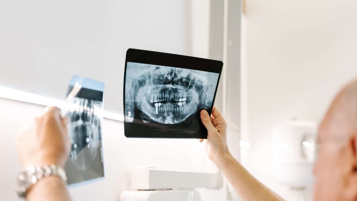 Relación entre cáncer y salud bucodental